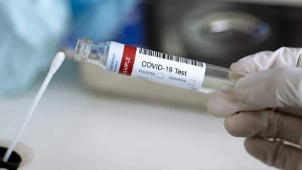 BENIN/COVID-19 : Le test Pcr désormais prescrit sur ordonnance médicale