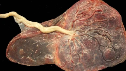 ENTERREMENT DU PLACENTA CHEZ LES BAATOMBU ET FON : Focus sur les rites et pratiques autour d’un organe vital pour l’enfant