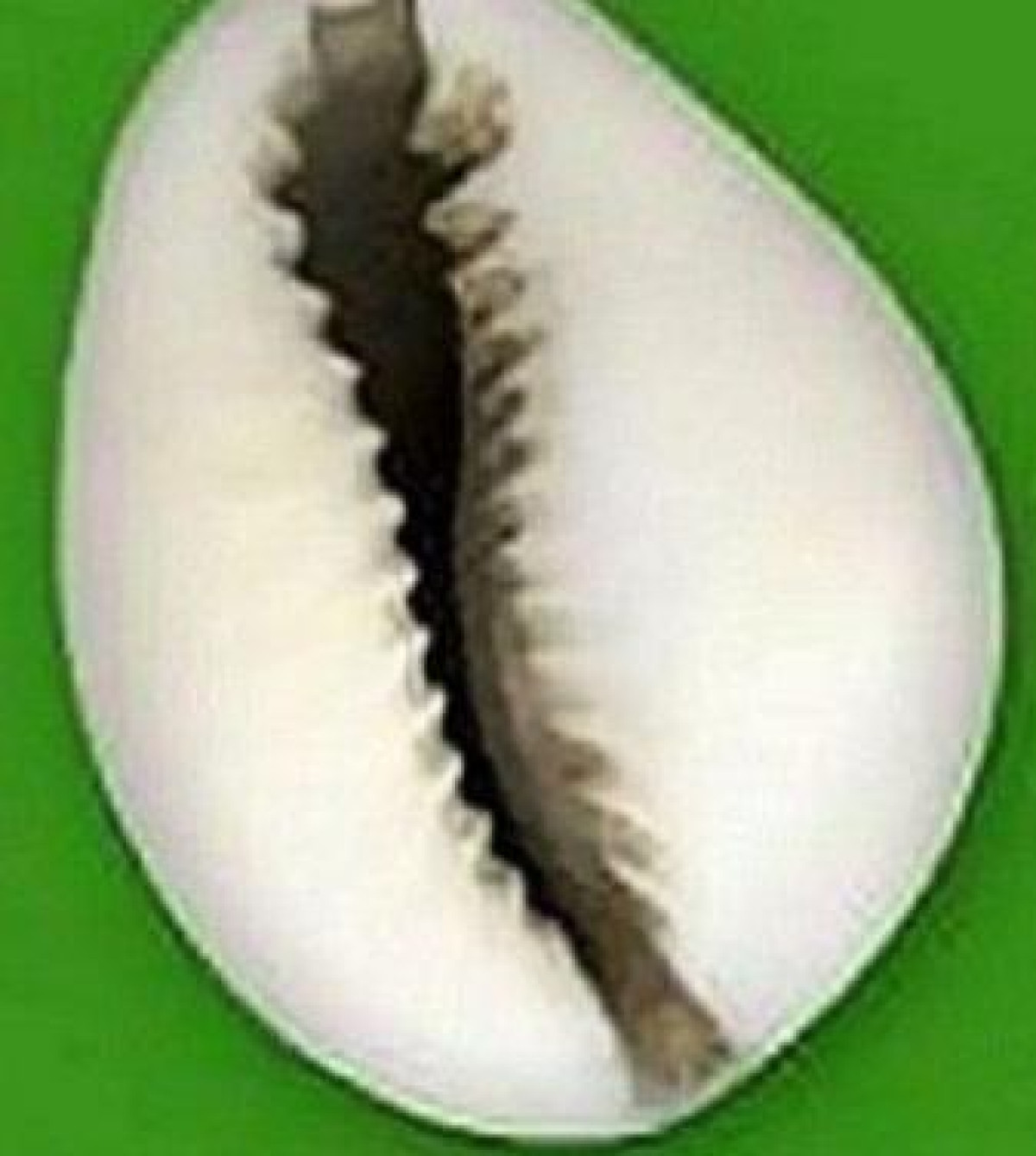 ÉDITO : Entre honneur et devoir ?