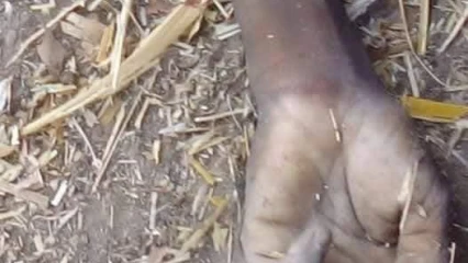 NIKKI/SUITE À UNE ALTERCATION  Un homme tranche le bras à son grand frère