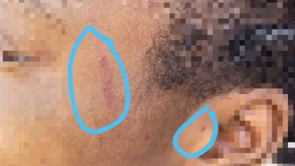 ABOMEY-CALAVI : Une étudiante victime d’une agression sexuelle