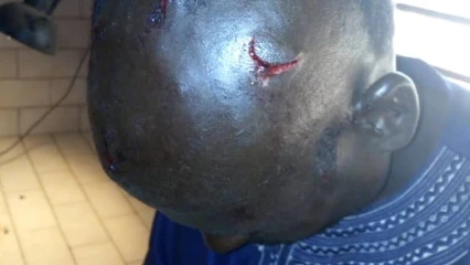 A DEUX JOURS DE LA SAINT VALENTIN A MALANVILLE : Par amour un homme fusille l’amant de sa femme et son conducteur