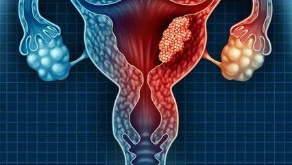 CANCER DU COL DE L’UTÉRUS : Il faut vaincre la fatalité 