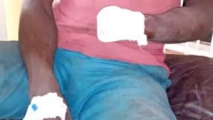 CONFLIT ENTRE AGRICULTEURS ET ELEVEURS A KALALE : Un bouvier ampute le poignet d&rsquo;un cultivateur