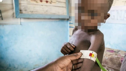MALNUTRITION : Une maladie méconnue avec de graves conséquences sur la santé