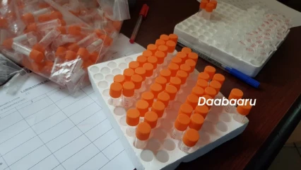 BENIN/COVID-19: 1500 tests déjà effectués à Parakou