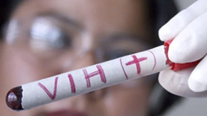 SANTÉ PUBLIQUE DANS L’ATACORA : 2 949 personnes dont 210 enfants porteuses du Vih/Sida  . Le risque d’une propagation