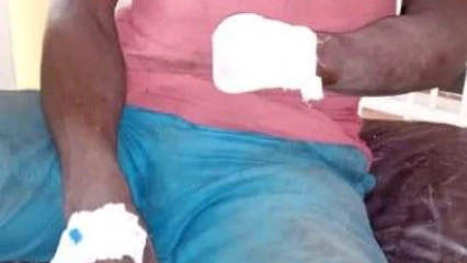 CONFLIT ENTRE AGRICULTEURS ET ELEVEURS A KALALE : Un bouvier ampute le poignet d&rsquo;un cultivateur