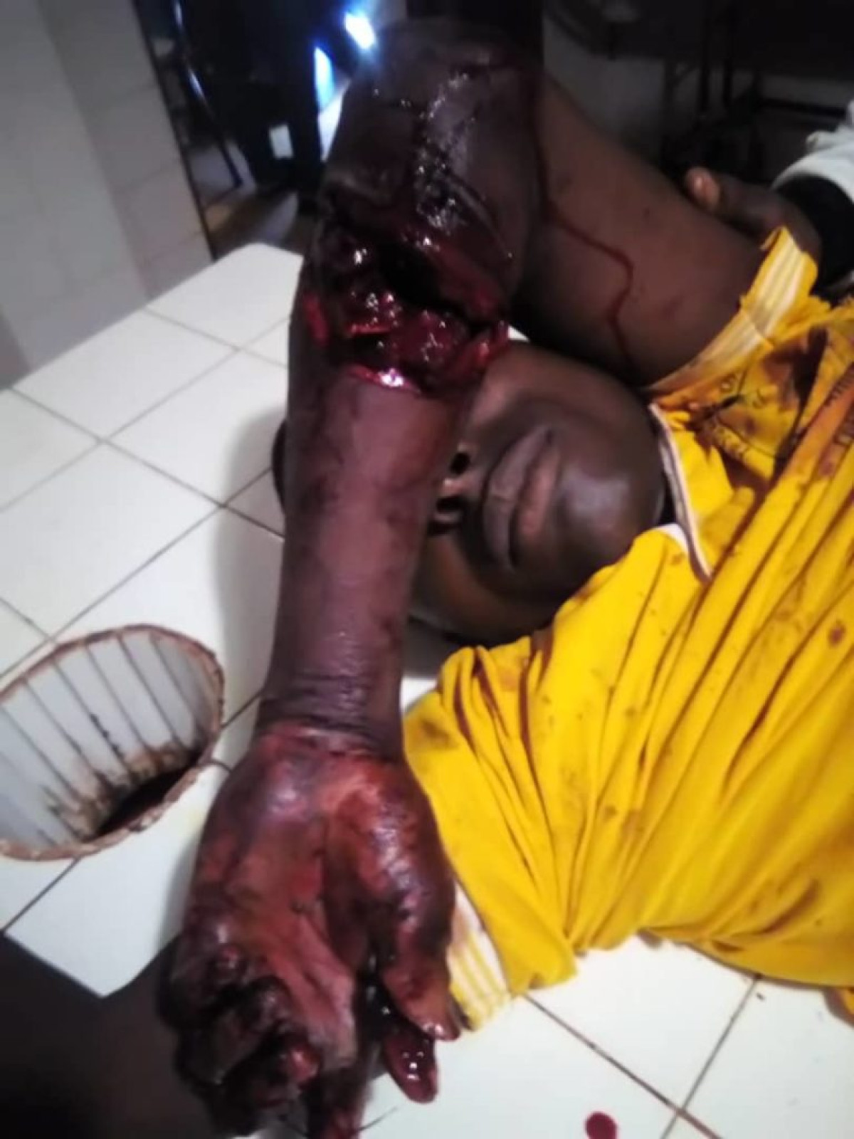 BENIN /INSÉCURITÉ : Un jeune perd ses doigts et sa moto dans un braquage à Kouandé