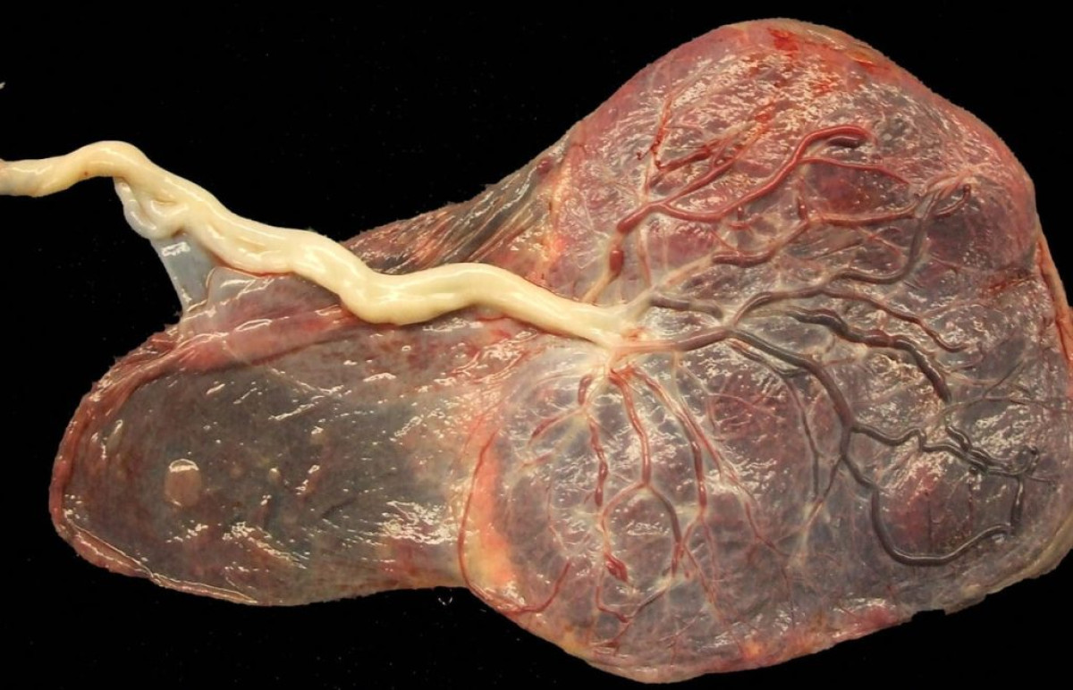 ENTERREMENT DU PLACENTA CHEZ LES BAATOMBU ET FON : Focus sur les rites et pratiques autour d&rsquo;un organe vital pour l’enfant
