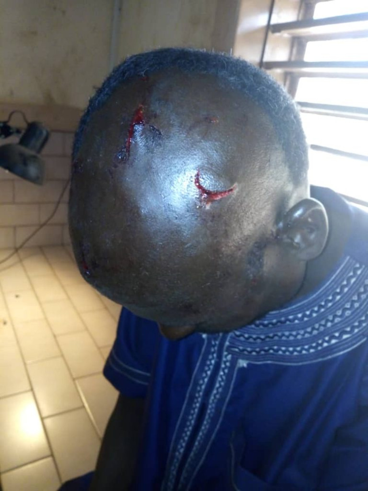 A DEUX JOURS DE LA SAINT VALENTIN A MALANVILLE : Par amour un homme fusille l’amant de sa femme et son conducteur