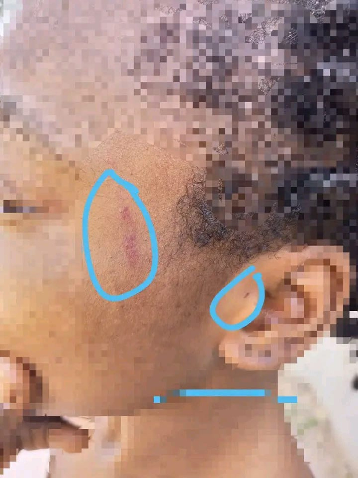 ABOMEY-CALAVI : Une étudiante victime d&rsquo;une agression sexuelle