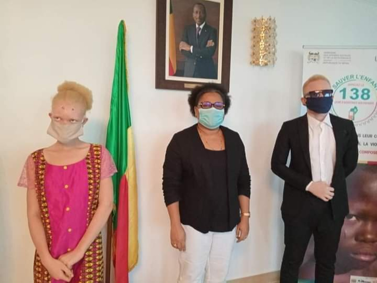 JOURNEE MONDIALE DE SENSIBILISATION A L’ALBINISME : La ministre Tognifodé réitère sa solidarité aux personnes atteintes d’albinisme