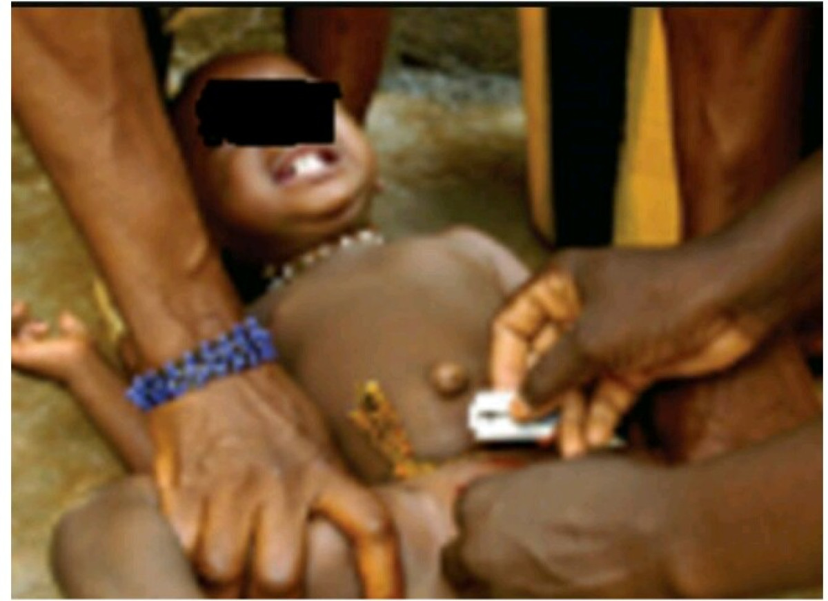 MUTILATIONS GENITALES FÉMININES AU BENIN : La Dgfas fait l’état des lieux