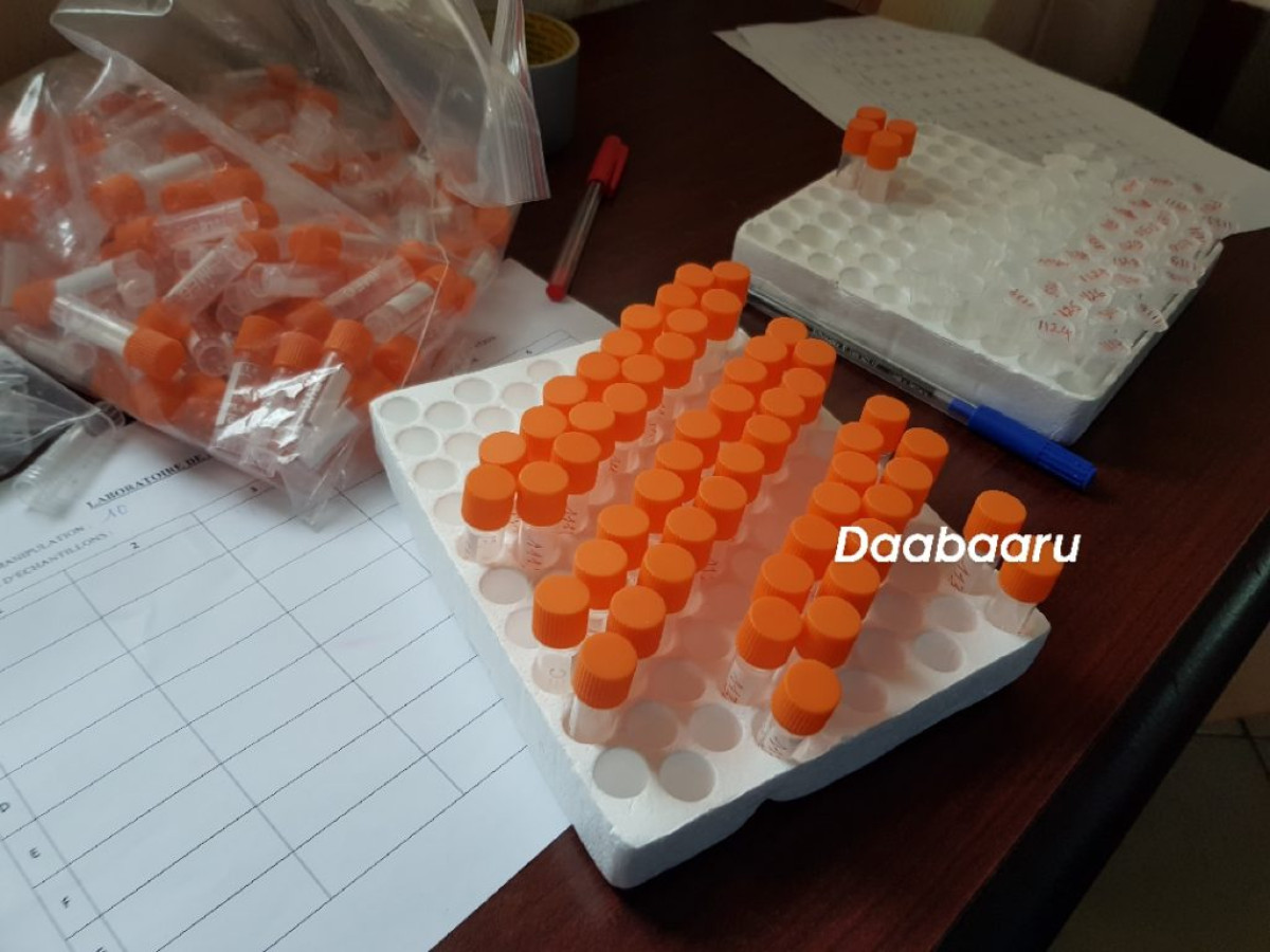 BENIN/COVID-19: 1500 tests déjà effectués à Parakou