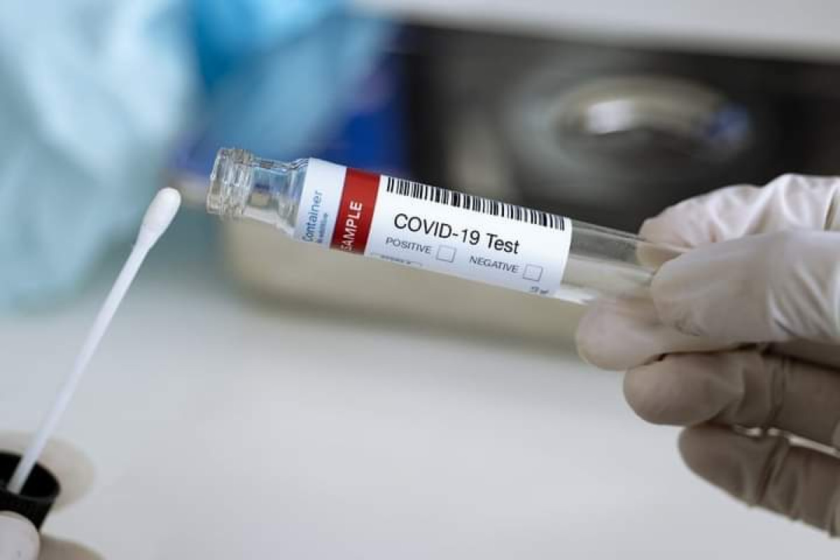 BENIN/COVID-19 : Le test Pcr désormais prescrit sur ordonnance médicale
