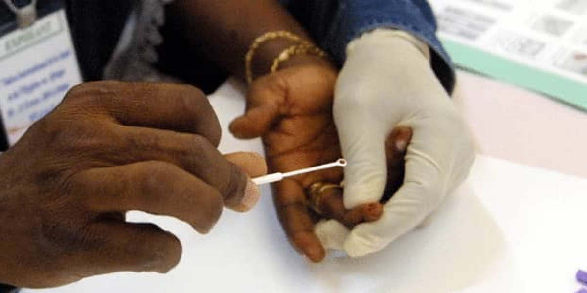 TEST D&rsquo;ÉLECTROPHORÈSE AVANT LE  MARIAGE : Une alternative pour sauver les enfants des griffes d&rsquo;un terrible mal