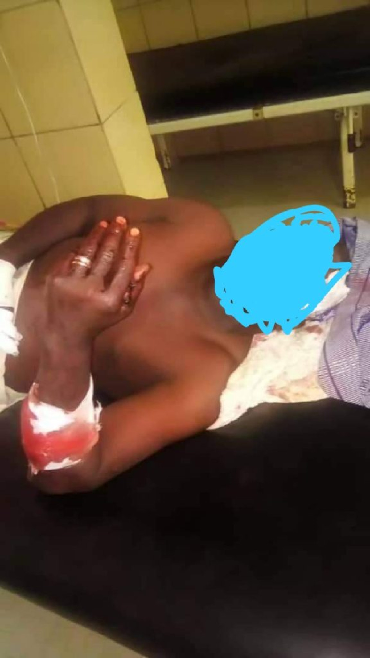 BENIN/COMMUNALE 2020 : Un candidat charcuté à Matéri