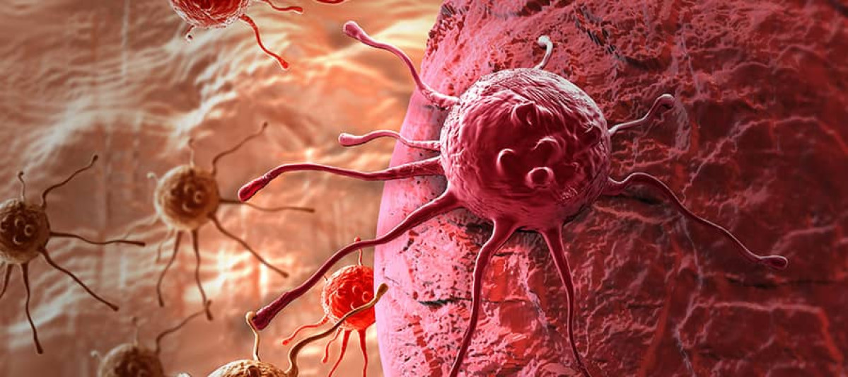 SANTE : Tout sur le cancer